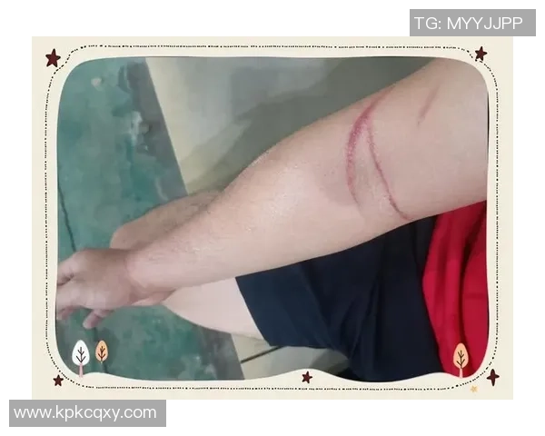 打篮球时腿部拉伤后应如何选择合适的药物进行治疗和缓解疼痛